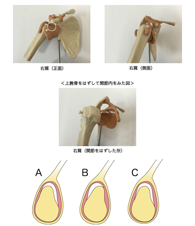 投球障害(肩関節)
