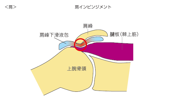 投球障害(肩関節)