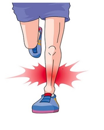 >脛骨疲労骨折・シンスプリント